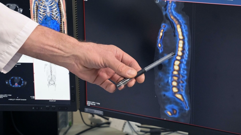 Израильские ученые создали имплантат спинного мозга из жира человека