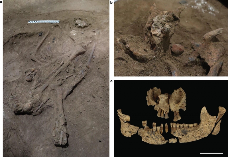 "Отрубили ногу". Находка археологов изменила взгляд на историю медицины