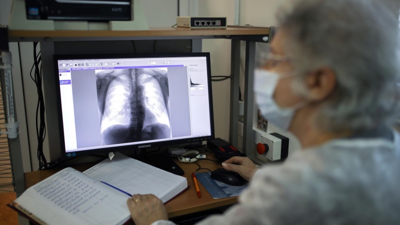 Российские ученые создали источник питания для рентгеновских аппаратов