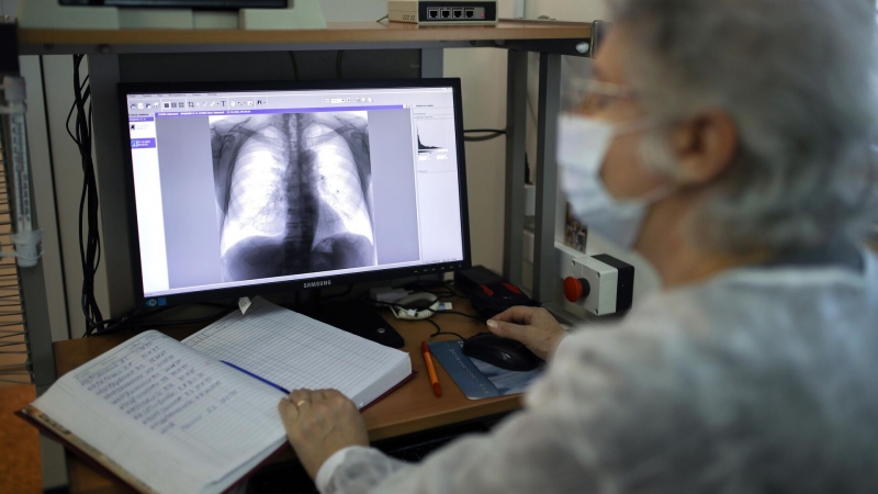 Российские наноиглы продлят срок работы рентген-аппаратов в десятки раз