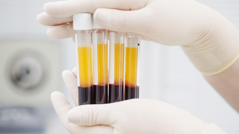 Российские ученые разрабатывают препарат из донорской плазмы крови