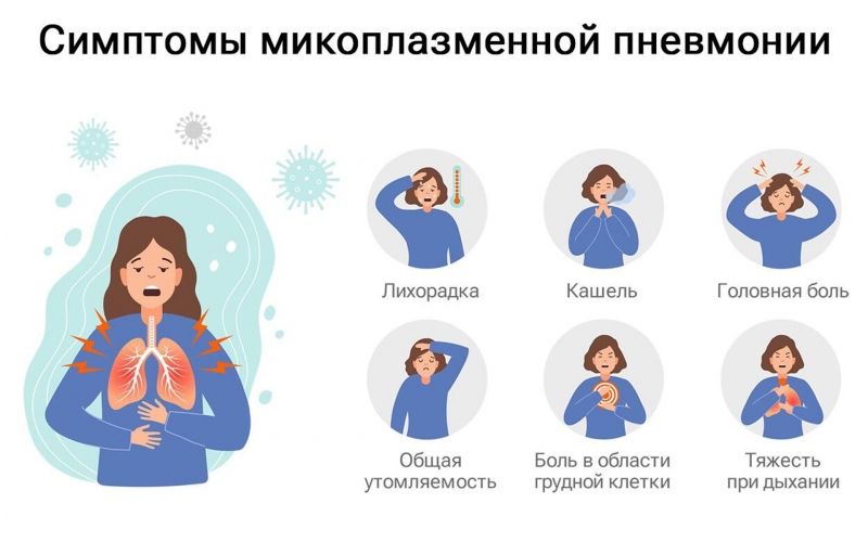 Вспышка микоплазмы в России. Что известно, какие симптомы