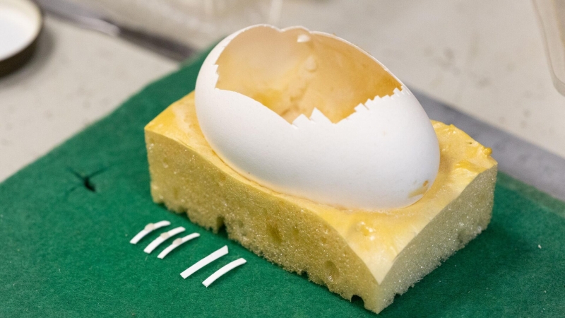 Российские ученые пересмотрели "золотой стандарт" в стоматологии