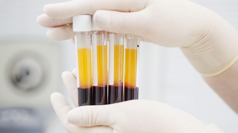 В России предложили состав для безопасной консервации крови