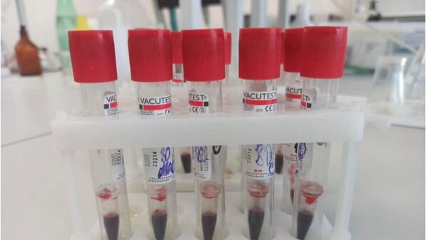 В России предложили состав для безопасной консервации крови