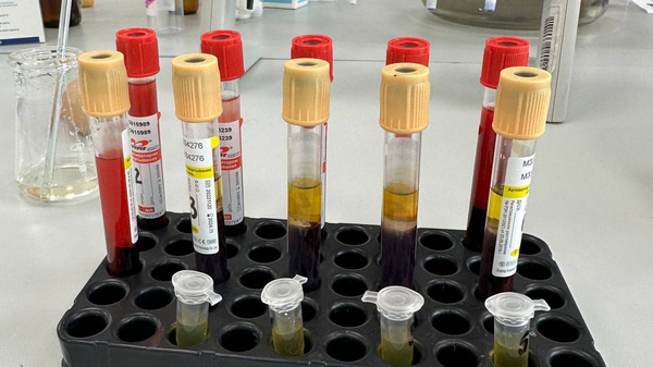 В России предложили состав для безопасной консервации крови