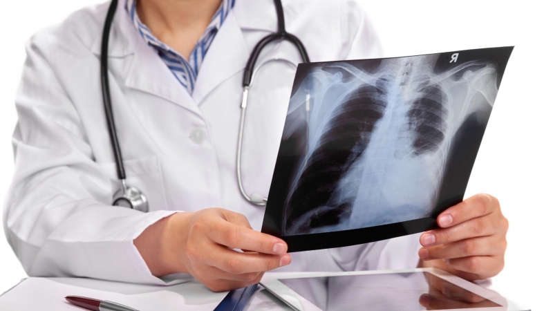 В Гонконге разработали препарат, запускающий самоуничтожение клеток рака