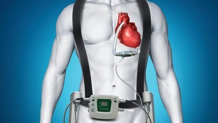 В России создали прибор для быстрой диагностики сердца