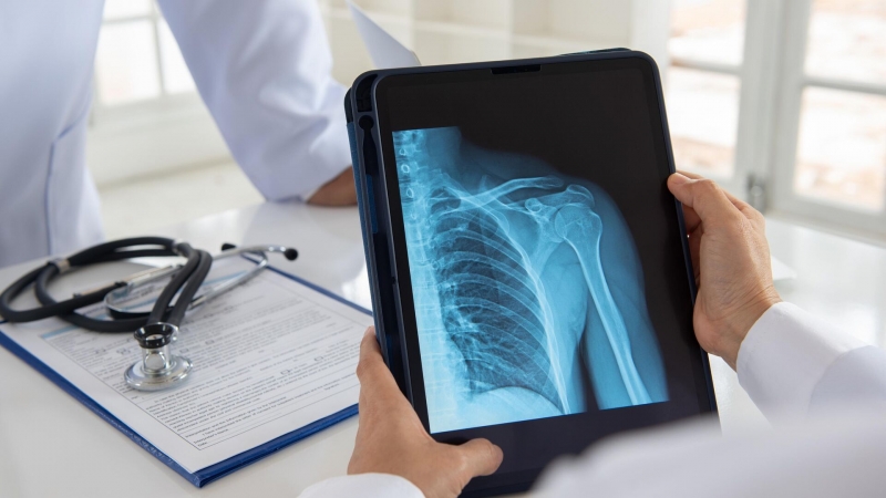 В России создали новый комплекс для борьбы с остеопорозом