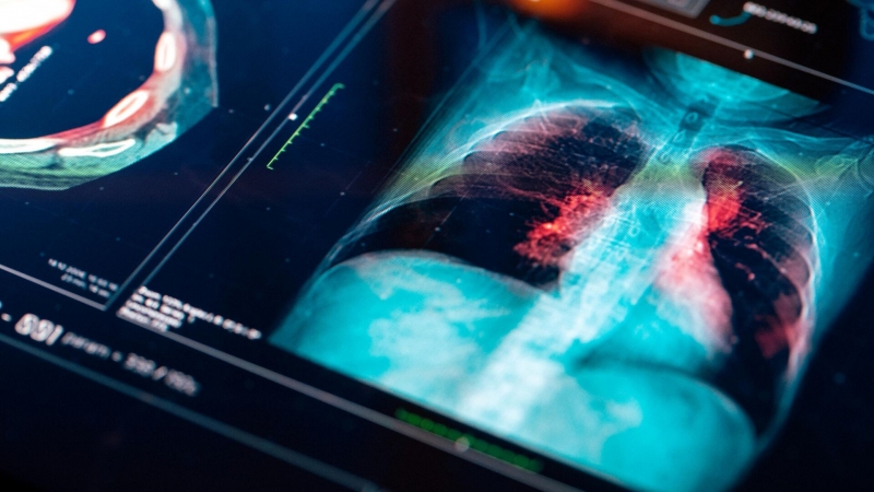 Ученые выяснили, почему в 30 лет можно чувствовать себя на 60