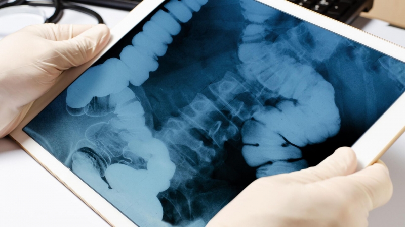 Найдены ранее неизвестные свойства раковой опухоли