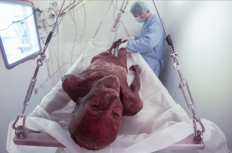 Проклятие "ледяного человека": как мумия из каменного века отомстила ученым