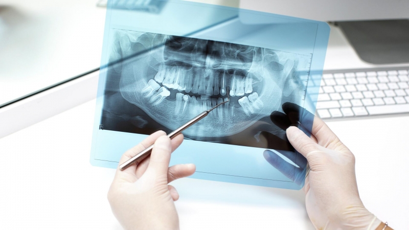 Ученые разработали пленку для зубов "стоп кариес"