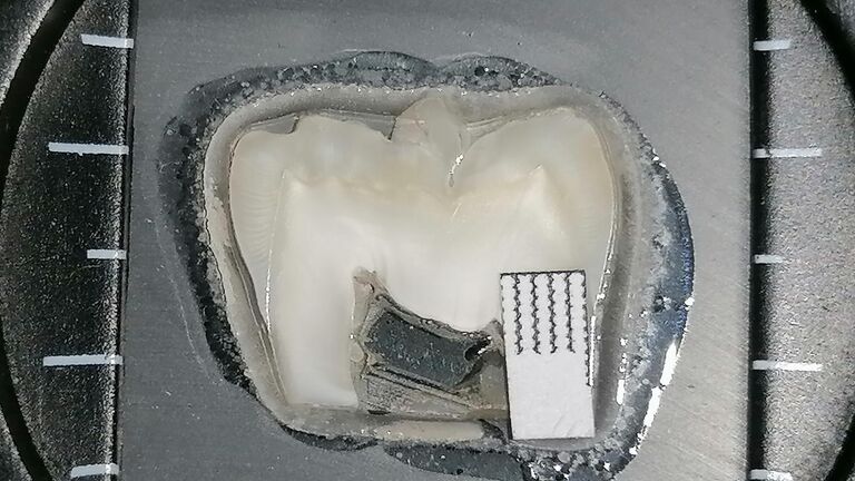 Ученые разработали пленку для зубов "стоп кариес"