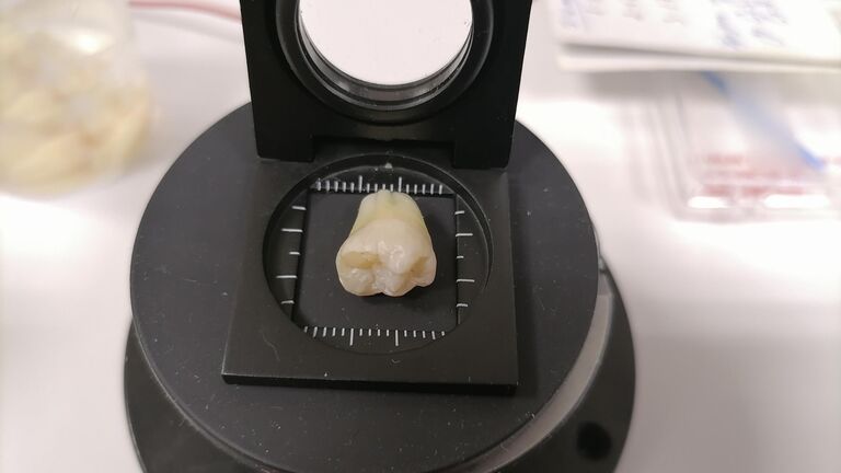 Ученые разработали пленку для зубов "стоп кариес"