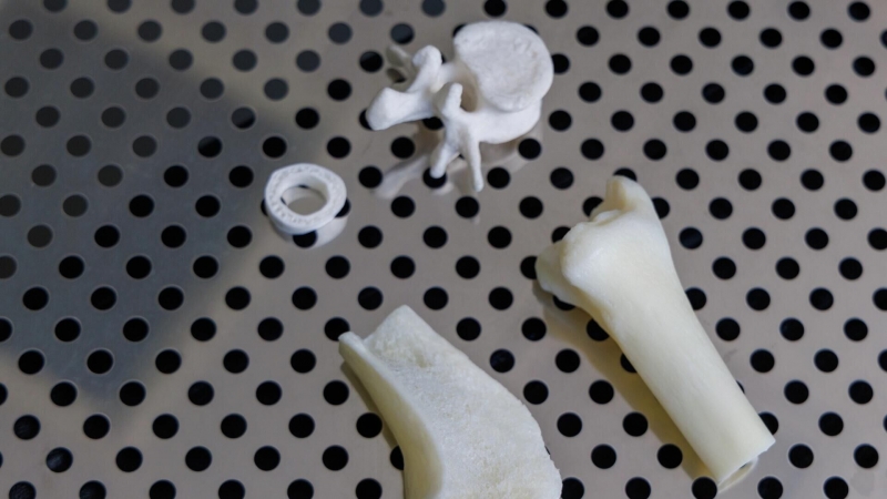 Ученые улучшили "зрение" рентгеновских аппаратов