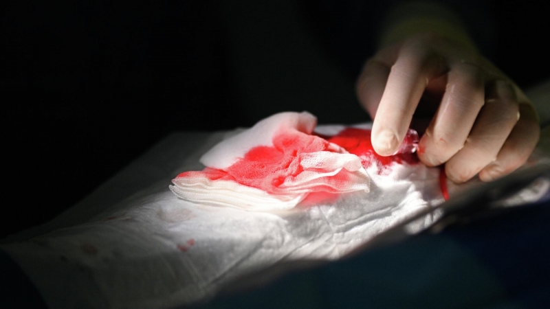 "По принципу русских пельменей". Найден новый подход к лечению тяжелых ран