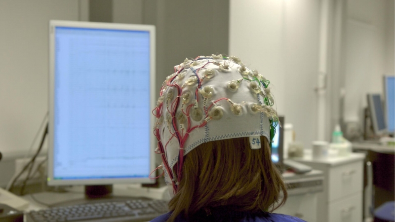 Найден новый способ лечения эпилепсии