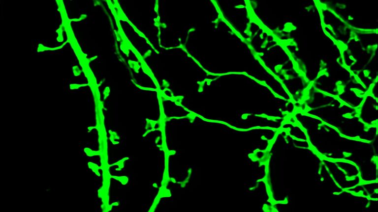 Российские ученые улучшили микроскоп